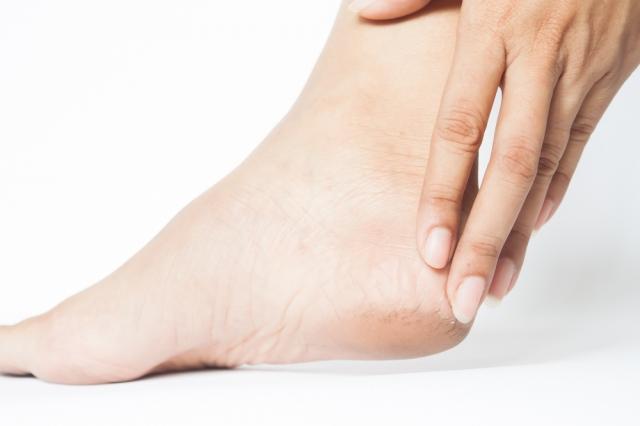 Top Remedies for Cracked Heels